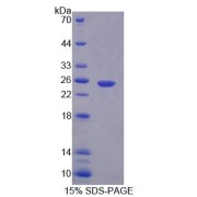SDS-PAGE analysis of Human CAPN7 Protein.