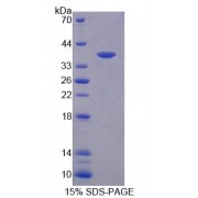 SDS-PAGE analysis of recombinant Human Centrosomal Protein 55 kDa (CEP55) Protein.