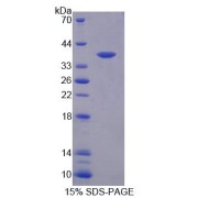 SDS-PAGE analysis of recombinant Human Centrosomal Protein 55 kDa (CEP55) Protein.