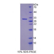 SDS-PAGE analysis of Rat TJP3 Protein.