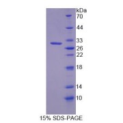 SDS-PAGE analysis of Rat TJP3 Protein.