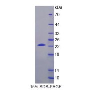 SDS-PAGE analysis of Mouse CHKb Protein.