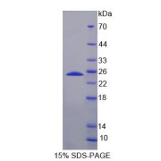 SDS-PAGE analysis of Human FDXR Protein.