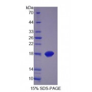 SDS-PAGE analysis of Human MCEE Protein.
