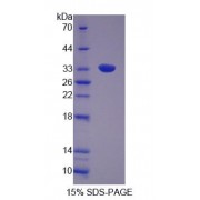 SDS-PAGE analysis of Rat GRB14 Protein.
