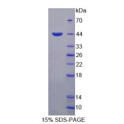 SDS-PAGE analysis of Human HIPK4 Protein.