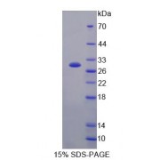 SDS-PAGE analysis of Human HMHA1 Protein.