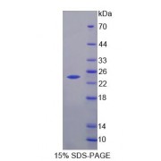 SDS-PAGE analysis of recombinant Human HPCAL4 Protein.