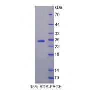 SDS-PAGE analysis of recombinant Human HPCA Protein.