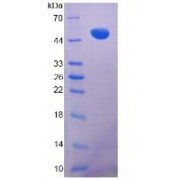 SDS-PAGE analysis of recombinant Mouse VIM Protein.