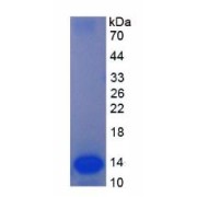 SDS-PAGE analysis of Mouse AD Protein.