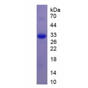 Brain Derived Neurotrophic Factor (BDNF) Protein