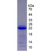 SDS-PAGE analysis of Human SERPINB4 Protein.