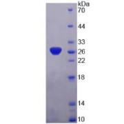 SDS-PAGE analysis of recombinant SNAP25 Protein.