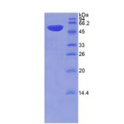 SDS-PAGE analysis of Rat THBS2 Protein.