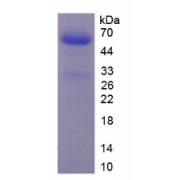 SDS-PAGE analysis of Human F10 Protein.
