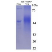 SDS-PAGE analysis of N-Terminal Pro-Brain Natriuretic Peptide Protein (OVA).