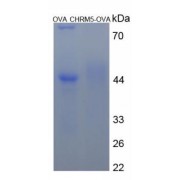 SDS-PAGE analysis of CHRM5 Protein (OVA).