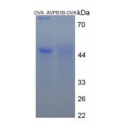 SDS-PAGE analysis of Arginine Vasopressin Receptor 1B Protein (OVA).
