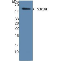 Human Neutrophil Elastase (ELANE) Protein (Active)