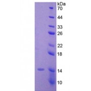 Human Muellerian-Inhibiting Factor (AMH) Protein (Active)