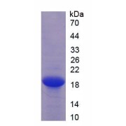 Human Endothelial Cell Specific Molecule 1 (ESM1) Protein (Active)