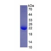 Human Interleukin 1 Beta (IL1b) Protein (Active)