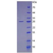 Human Leukemia Inhibitory Factor (LIF) Protein (Active)