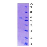 Human Nerve Growth Factor (NGF) Protein (Active)