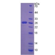 Human Sialidase-1 (NEU1) Protein (Active)