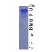 Human Osteopontin (SPP1) Protein (Active)