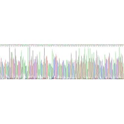Human Osteopontin (SPP1) Protein (Active)