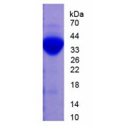 Rat Plasminogen (Plg) Protein (Active)