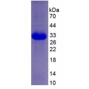 SDS-PAGE analysis of recombinant Human PKR.