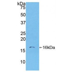 Human S100 Calcium Binding Protein A6 (S100A6) Protein