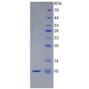 Mouse S100 Calcium Binding Protein B (S100B) Protein