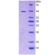 Human Tumor Necrosis Factor Receptor Superfamily Member 12A (TNFRSF12A) Protein (Active)