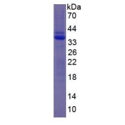SDS-PAGE analysis of recombinant Human PLG.