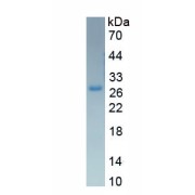 SDS-PAGE analysis of Human Sex Hormone Binding Globulin (SHBG) Protein.