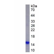 SDS-PAGE analysis of native Human Hemoglobin Protein.