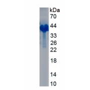SDS-PAGE analysis of recombinant Human Procollagen Type I N-Terminal Propeptide (PINP) Protein.
