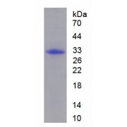 SDS-PAGE analysis of recombinant Human Hyaluronan Synthase 1 HAS1 Protein.