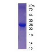 Human Troponin I Type 2, Fast Skeletal (TNNI2) Protein
