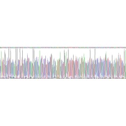 Human Cholesterol-25-Hydroxylase (CH25H) Protein
