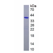 SDS-PAGE analysis of recombinant Human Myristoylated Alanine Rich Protein Kinase C Substrate MARCKS Protein.