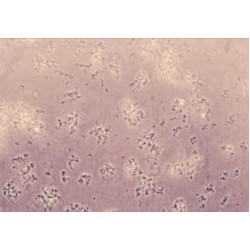 Human Perforin-1 (PRF1) Protein (Active)