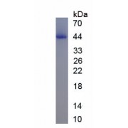 SDS-PAGE analysis of recombinant Rat ACTA1 Protein.