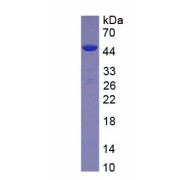 SDS-PAGE analysis of recombinant Human Activating Signal Cointegrator 1 Complex Subunit 3 (ASCC3) Protein.