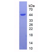 SDS-PAGE analysis of recombinant Human ACE2 protein.