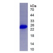SDS-PAGE analysis of recombinant Human AANAT Protein.